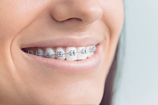 Best Invisalign and Clear Aligners  in , WY